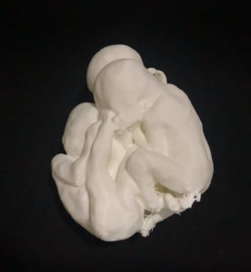 models of fetal malformations x