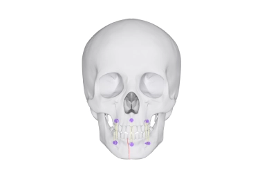 Cirurgia Ortognática ()