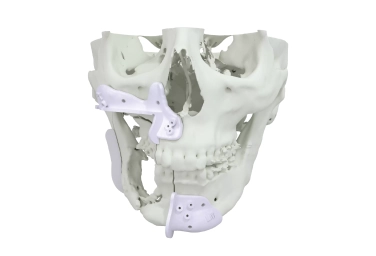 Cirurgia Ortognática ()