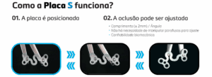 PLACA S ()